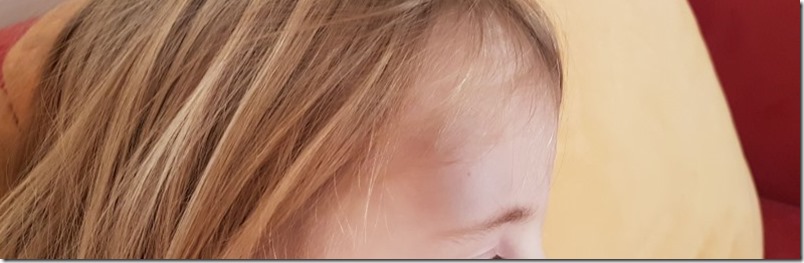 WIB: Unfall im Kindergarten und krank - MamaZ